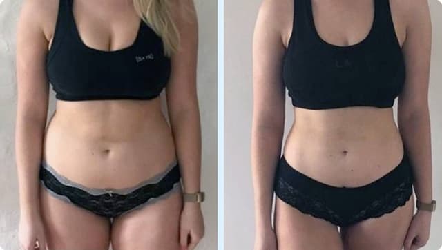 Weight Loss